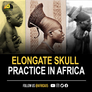 Elongated Skull practice in Africa